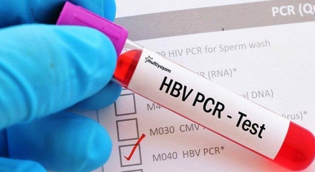 Şanlıurfa'da PCR testi zorunluluğu kaldırıldı